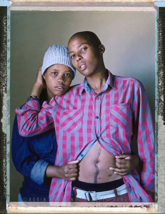 A posed portrait of 20 year old Olwetu with her partner Ntombozuko, 31. They say that they face verbal abuse everyday in the township of Khayelitsha. They are called ‘Tom Boys’ and ‘Witches.’ Twice Ntombozuko has been violently attacked because of her sexuality. The first time was in 2010 when, late one night, she was out with her friends. A group of drunken men started shouting at her and her friends: “here’s these bitches trying to steal our girls”. The three men then attacked. Ntombozuko was knocked to the ground and beaten. Her friends were beaten as well. The second time, in 2013, she was walking home late one night when a group of men surrounded her and attacked her. A car came down the road and they ran. It was then that she saw the blood on her shirt. She survived the attack but lives in fear of the streets outside her front door: “Even now I’m not feeling safe when I walk in the street”. She says the love of her partner has helped her to recover from the pain. They have been together 8 months and hope to marry. South Africa. November 2014.  While many countries around the world are legally recognizing same-sex relationships, individuals in nearly 80 countries face criminal sanctions for private consensual relations with another adult of the same sex. Violence and discrimination based on sexual orientation or gender expression is even more widespread. Africa is becoming the worst continent for Lesbian, Gay, Bi-sexual, Transgender, Queer, Inter-sex (LGBTQI) individuals. More than two thirds of African countries have laws criminalizing consensual same-sex acts. In some, homosexuality is punishable by death. In Nigeria new homophobic laws introduced in 2013 led to dramatic increase in attacks. Under Sharia Law, homosexuality is punishable by death, up to 50 lashes and six months in prison for woman; for men elsewhere, up to 14 years in prison. Same sex acts are illegal in Uganda. A discriminatory law was passed then struck down and homophobic attacks rose tenfold after the passage of the Anti-Homosexuality Act. In Cameroon it is also illegal. More cases against suspected homosexuals are brought here than any other African country. In stark contrast with the rest of the continent, same sex relationships are legal in South Africa. The country has the most liberal laws toward gays and lesbians on the continent, with a constitution guaranteeing LBGTQI rights. Because of this, LGBTQI Africans from all over the continent fleeing persecution have come to South Africa. Despite these laws, many lesbians have been victims of ‘corrective rape’ and homosexuals have been murdered for their sexuality. Homophobia is by no means just an African problem. In Russia, politicians spread intolerance. In June 2013 the country passed a law making “propaganda” about “non-traditional sexual relationships” a crime. Attacks against gays rose. Videos of gay men being tortured have been posted online. In predominantly Muslim Malaysia, law currently provides for whipping and up to a 20-year prison sentence for homosexual acts involving either men or women. Increased extreme Islamification in the Middle East is making life more dangerous for gay men there, as evidenced by ISIS’s recent murders of homosexual men. While homophobic discrimination is widespread in Lebanon, life is much safer there than Iran, Iraq, and Syria from which refugees are fleeing due to homophobic persecution. Photo Robin Hammond/Panos for Witness Change